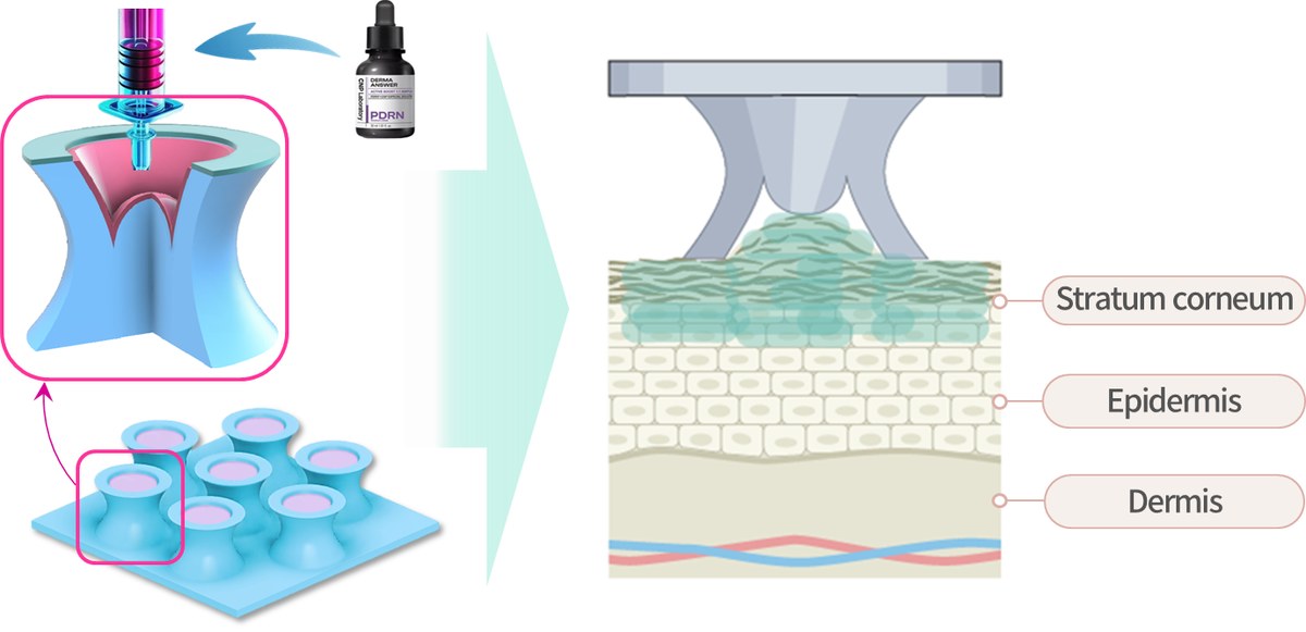 Suction-type microstructured patch conforming to skin and driving a topical agent into the stratum corneum